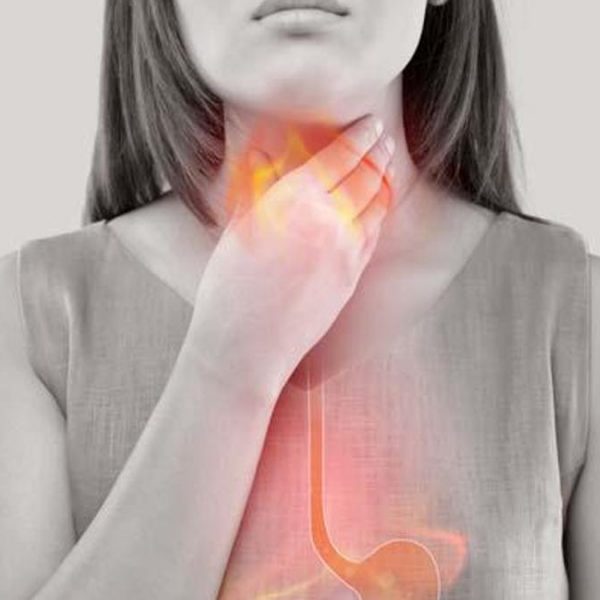 Gastroözofageal reflü hastalığı nedir ve nasıl tedavi edilir?