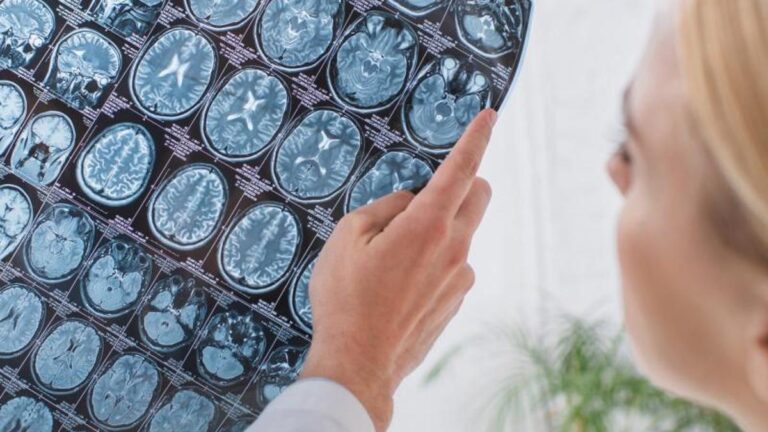 Uzmanından beyin sağlığına faydalı beslenme önerileri