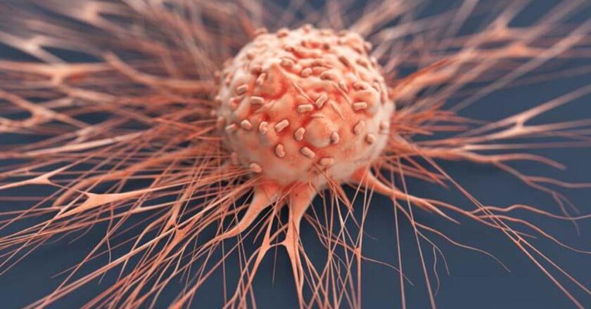 Kanserde Büyük Başarı: Bazı Türlerde İyileşme Oranı Yükseldi